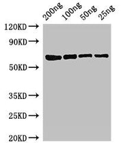 Western Blot Positive WB detected in Recombinant protein All lanes: mutL antibody at 3ug/ml Secondary Goat polyclonal to rabbit IgG at 1/50000 dilution predicted band size: 68 kDa observed band size: 68 kDa