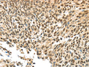 The image on the left is immunohistochemistry of paraffin-embedded Human tonsil tissue using CSB-PA545148(APOL6 Antibody) at dilution 1/60, on the right is treated with synthetic peptide. (Original magnification: ×200)