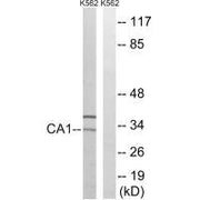 Western blot analysis of extracts from K562 cells, using CA1 antibody.