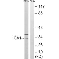 Western blot analysis of extracts from K562 cells, using CA1 antibody.