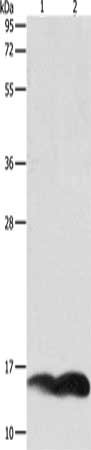 Gel: 12%SDS-PAGE, Lysate: 10 ug, Lane 1-2: A549 cells, Jurkat cells, Primary antibody: CSB-PA545773(PFN1 Antibody) at dilution 1/1000, Secondary antibody: Goat anti rabbit IgG at 1/8000 dilution, Exposure time: 5 minutes