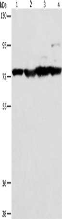 Gel: 8%SDS-PAGE, Lysate: 40 ug, Lane 1-4: Mouse stomach tissue, Mouse heart tissue, Mouse liver tissue, HT29 cells, Primary antibody: CSB-PA545776(MMP15 Antibody) at dilution 1/200, Secondary antibody: Goat anti rabbit IgG at 1/8000 dilution, Expo...