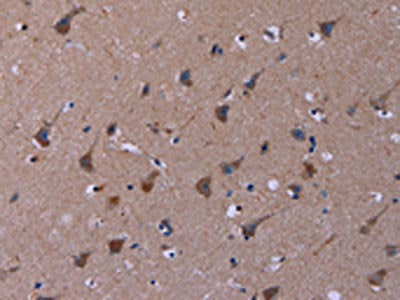 The image on the left is immunohistochemistry of paraffin-embedded Human brain tissue using CSB-PA545808(TUBGCP2 Antibody) at dilution 1/50, on the right is treated with synthetic peptide. (Original magnification: ×200)