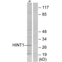 Western blot analysis of extracts from Jurkat cells, using HINT1 antibody.