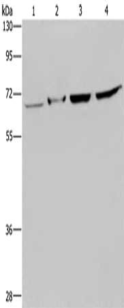 Gel: 8%SDS-PAGE, Lysate: 40 ug, Lane 1-4: Human testis tissue, mouse liver tissue, Hela cells, 293T cells, Primary antibody: CSB-PA546627(HACL1 Antibody) at dilution 1/200, Secondary antibody: Goat anti rabbit IgG at 1/8000 dilution, Exposure time...