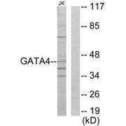 Western blot analysis of extracts from Jurkat cells, using GATA4 antibody.