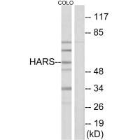 Western blot analysis of extracts from HeLa cells, using HARS antibody.