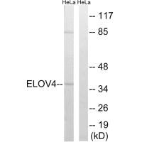Western blot analysis of extracts from HeLa cells, using ELOVL4 antibody.