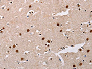 The image on the left is immunohistochemistry of paraffin-embedded Human brain tissue using CSB-PA547116(AKAP8L Antibody) at dilution 1/20, on the right is treated with fusion protein. (Original magnification: ×200)