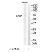 Western blot analysis of extracts from HepG2 cells, using ACHE antibody.