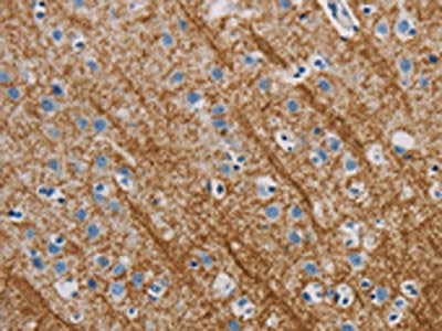 The image is immunohistochemistry of paraffin-embedded Human brain tissue using CSB-PA547318(ABL1 Antibody) at dilution 1/40. (Original magnification: 200)