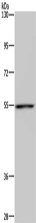 Gel: 6%SDS-PAGE, Lysate: 40 ug, Lane: Mouse lung tissue, Primary antibody: CSB-PA547732(CYP1A1 Antibody) at dilution 1/220, Secondary antibody: Goat anti rabbit IgG at 1/8000 dilution, Exposure time: 30 seconds
