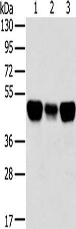 Gel: 8%SDS-PAGE, Lysate: 40 ug, Lane 1-3: Lovo cells, A549 cells, hela cells, Primary antibody: CSB-PA548244(TRIM21 Antibody) at dilution 1/400, Secondary antibody: Goat anti rabbit IgG at 1/8000 dilution, Exposure time: 10 seconds