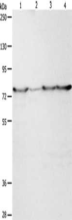 Gel: 8%SDS-PAGE, Lysate: 40 ug, Lane 1-4: Hela cells, human fetal liver tissue, 231 cells, A549 cells, Primary antibody: CSB-PA548387(PEG10 Antibody) at dilution 1/200, Secondary antibody: Goat anti rabbit IgG at 1/8000 dilution, Exposure time: 1...