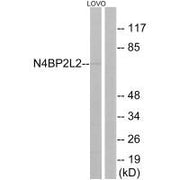 Western blot analysis of extracts from LOVO cells, using N4BP2L2 antibody.