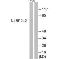 Western blot analysis of extracts from LOVO cells, using N4BP2L2 antibody.