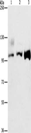 Gel: 8%SDS-PAGE, Lysate: 40 ug, Lane 1-3: A431 cells, 293T cells, hela cells, Primary antibody: CSB-PA548485(ASCC2 Antibody) at dilution 1/500, Secondary antibody: Goat anti rabbit IgG at 1/8000 dilution, Exposure time: 30 seconds