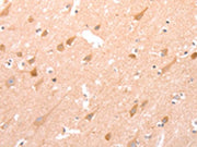 The image on the left is immunohistochemistry of paraffin-embedded Human brain tissue using CSB-PA549056(STRA8 Antibody) at dilution 1/25, on the right is treated with synthetic peptide. (Original magnification: ×200)