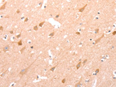 The image on the left is immunohistochemistry of paraffin-embedded Human brain tissue using CSB-PA549056(STRA8 Antibody) at dilution 1/25, on the right is treated with synthetic peptide. (Original magnification: ×200)