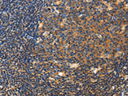 The image on the left is immunohistochemistry of paraffin-embedded Human tonsil tissue using CSB-PA549396(CERK Antibody) at dilution 1/50, on the right is treated with fusion protein. (Original magnification: ×200)
