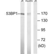 Western blot analysis of extracts from Jurkat cells and HUVEC cells, using 53BP1 (Ab-29) antibody.