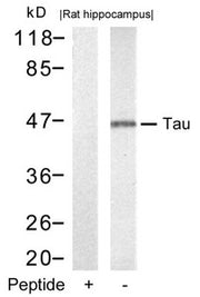 Western blot analysis of extracts from rat hippocampus tissue using Tau(Ab-212) Antibody and the same antibody preincubated with blocking peptide.
