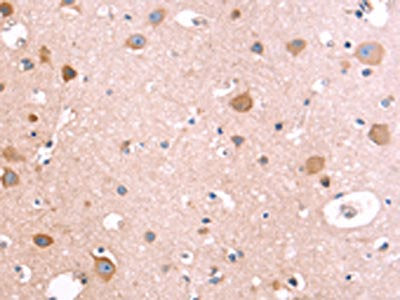 The image on the left is immunohistochemistry of paraffin-embedded Human brain tissue using CSB-PA550856(IL1RL1 Antibody) at dilution 1/40, on the right is treated with fusion protein. (Original magnification: ×200)