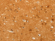 The image on the left is immunohistochemistry of paraffin-embedded Human brain tissue using CSB-PA550936(POU5F1 Antibody) at dilution 1/30, on the right is treated with fusion protein. (Original magnification: ×200)
