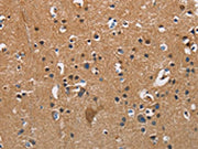 The image on the left is immunohistochemistry of paraffin-embedded Human brain tissue using CSB-PA551448(APOA1 Antibody) at dilution 1/25, on the right is treated with fusion protein. (Original magnification: ×200)