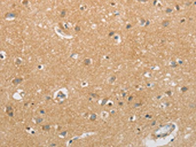 The image on the left is immunohistochemistry of paraffin-embedded Human brain tissue using CSB-PA551964(GJB6 Antibody) at dilution 1/60, on the right is treated with synthetic peptide. (Original magnification: ×200)