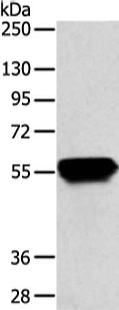 Gel: 8%SDS-PAGE, Lysate: 40 ug, Lane: Hela cell, Primary antibody: CSB-PA552024(KRT4 Antibody) at dilution 1/800 dilution, Secondary antibody: Goat anti rabbit IgG at 1/8000 dilution, Exposure time: 15 seconds