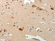 The image on the left is immunohistochemistry of paraffin-embedded Human brain tissue using CSB-PA552311(SREBF2 Antibody) at dilution 1/30, on the right is treated with synthetic peptide. (Original magnification: ×200)