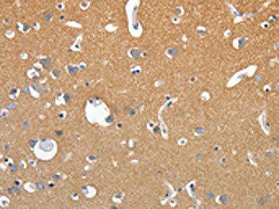 The image on the left is immunohistochemistry of paraffin-embedded Human brain tissue using CSB-PA552452(SSTR4 Antibody) at dilution 1/20, on the right is treated with synthetic peptide. (Original magnification: ×200)