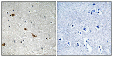 Immunohistochemical analysis of paraffin-embedded human brain tissue using IKK-γ (Phospho-Ser376) antibody (left)or the same antibody preincubated with blocking peptide (right).