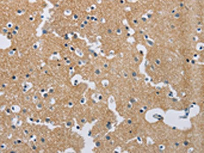 The image on the left is immunohistochemistry of paraffin-embedded Human brain tissue using CSB-PA553180(SYN2 Antibody) at dilution 1/40, on the right is treated with synthetic peptide. (Original magnification: ×200)