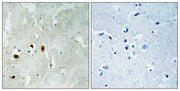 Immunohistochemical analysis of paraffin-embedded human brain tissue using Tip60 (Phospho-Ser90) antibody (left)or the same antibody preincubated with blocking peptide (right).