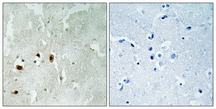 Immunohistochemical analysis of paraffin-embedded human brain tissue using Tip60 (Phospho-Ser90) antibody (left)or the same antibody preincubated with blocking peptide (right).