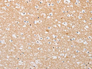 The image on the left is immunohistochemistry of paraffin-embedded Human brain tissue using CSB-PA554014(ATG9A Antibody) at dilution 1/30, on the right is treated with fusion protein. (Original magnification: ×200)