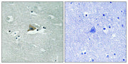 Immunohistochemical analysis of paraffin-embedded human brain tissue using Claudin 5 (Phospho-Tyr217) antibody (left)or the same antibody preincubated with blocking peptide (right).