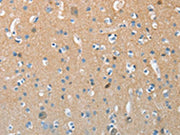 The image on the left is immunohistochemistry of paraffin-embedded Human brain tissue using CSB-PA554629(AURKC Antibody) at dilution 1/15, on the right is treated with synthetic peptide. (Original magnification: ×200)