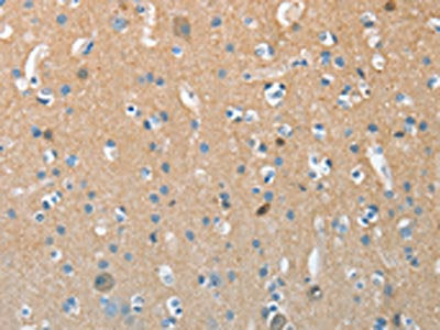 The image on the left is immunohistochemistry of paraffin-embedded Human brain tissue using CSB-PA554629(AURKC Antibody) at dilution 1/15, on the right is treated with synthetic peptide. (Original magnification: ×200)