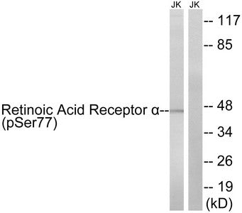Western blot analysis of extracts from Jurkat cells treated with PMA (125ng/ml, 30mins), using Retinoic Acid Receptor α(Phospho-Ser77) antibody. The lane on the right is treated with the synthesized peptide.