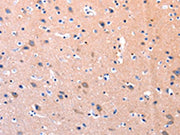 The image on the left is immunohistochemistry of paraffin-embedded Human brain tissue using CSB-PA554741(PTK2 Antibody) at dilution 1/75, on the right is treated with synthetic peptide. (Original magnification: ×200)