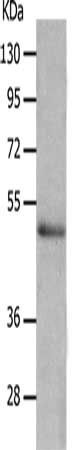 Gel: 10%SDS-PAGE, Lysate: 40 ug, Lane: Mouse thymus tissue, Primary antibody: CSB-PA554793(NCK2 Antibody) at dilution 1/350, Secondary antibody: Goat anti rabbit IgG at 1/8000 dilution, Exposure time: 15 minutes