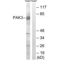 Western blot analysis of extracts from rat heart, using PAK3 (Ab-154) antibody.