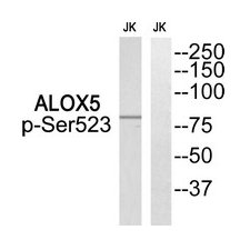 Western blot analysis of extracts from Jurkat cells, using ALOX5 (Phospho-Ser523) antibody. The lane on the right is treated with the synthesized peptide.