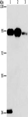 Gel: 6%SDS-PAGE, Lysate: 40 ug, Lane 1-3: Mouse stomach tissue, 293T cells, Jurkat cells, Primary antibody: CSB-PA555288(PLA2G4B Antibody) at dilution 1/1400, Secondary antibody: Goat anti rabbit IgG at 1/8000 dilution, Exposure time: 1 minute