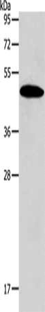 Gel: 12%SDS-PAGE, Lysate: 40 ug, Lane: Mouse liver tissue, Primary antibody: CSB-PA555914(SIRT7 Antibody) at dilution 1/600, Secondary antibody: Goat anti rabbit IgG at 1/8000 dilution, Exposure time: 20 seconds