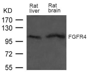 Western blot analysis of extract from Rat liver and Rat brain tissue using FGFR4 Antibody