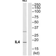 Western blot analysis of extracts from HeLa cells, using IL4 antibody.